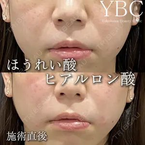 YBC横浜美容外科 池袋院 磯村 亮輔医師の症例