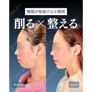 神戸美容外科 ネビュラクリニック 岩﨑 雅医師の症例