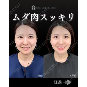 東京シンデレラ美容外科 池袋院 石井 達也医師の症例