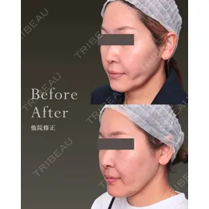 THE CLINIC（ザ・クリニック） 福岡院 安部 光洋医師の症例