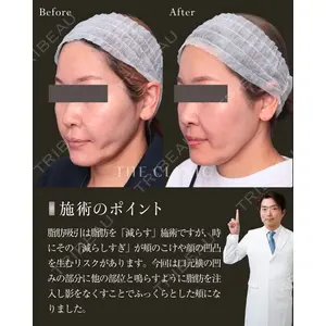 THE CLINIC（ザ・クリニック） 福岡院 安部 光洋医師の症例