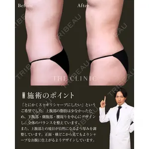 THE CLINIC（ザ・クリニック） 東京院 吉田 有希医師の症例