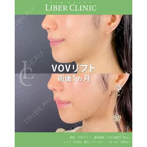 LIBER CLINIC 矢橋 洋一郎医師の症例