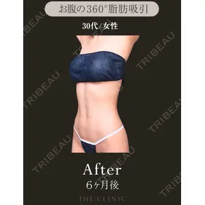 BUST CLINIC（バストクリニック） 東京 大橋 昌敬医師の症例