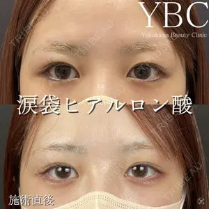 YBC横浜美容外科 立川院 大島 諒士医師の症例