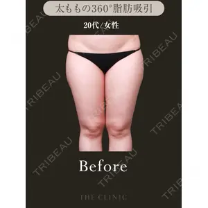 THE CLINIC（ザ・クリニック） 東京院 吉田 有希医師の症例