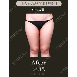 THE CLINIC（ザ・クリニック） 東京院 吉田 有希医師の症例