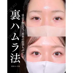 東京シンデレラ美容外科 大宮院 竹田 昌平医師の症例