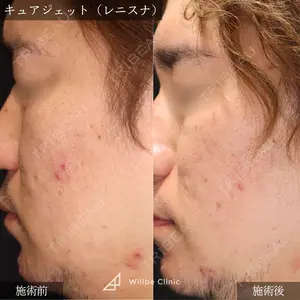 ウィルビークリニック 新宿院の症例