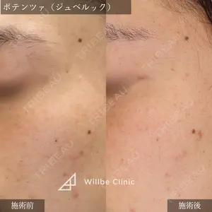 ウィルビークリニック 新宿院の症例