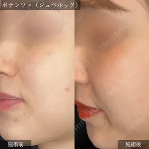 ウィルビークリニック 新宿院の症例