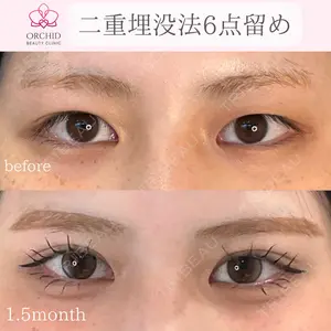 オーキッド美容クリニック東京御徒町 西浦 蘭子医師の症例