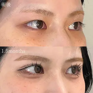 オーキッド美容クリニック東京御徒町 西浦 蘭子医師の症例