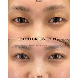 EMMO FACE CLINIC 大宮院 廣松 直樹医師の症例