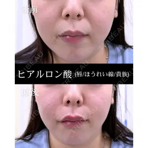 HAAB BEAUTY CLINIC 南青山本院（新院）の症例