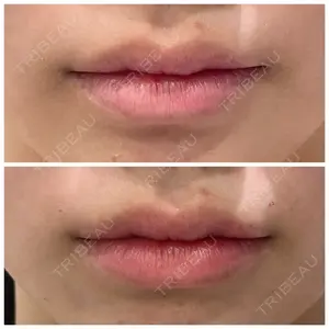 しのぶ皮膚科 蘇原しのぶ医師の症例
