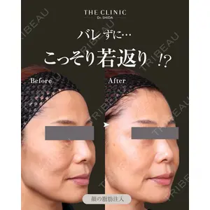 BUST CLINIC（バストクリニック） 東京 志田 雅明医師の症例