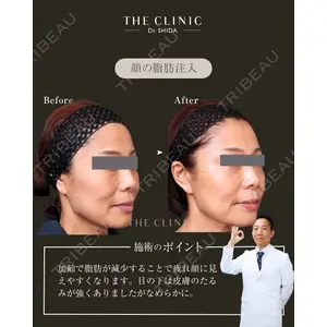 BUST CLINIC（バストクリニック） 東京 志田 雅明医師の症例