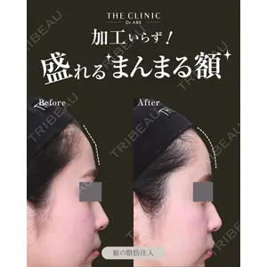 THE CLINIC（ザ・クリニック） 福岡院 安部 光洋医師の症例