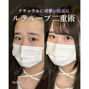 ルラ美容クリニック 岐阜院 馬場 愛理医師の症例