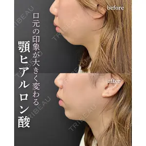 ルラ美容クリニック 岐阜院 馬場 愛理医師の症例