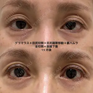 エターナル美容クリニック 久門田 詳医師の症例