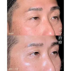 藤・ナチュレ美容クリニック 銀座院 小川 杏平医師の症例
