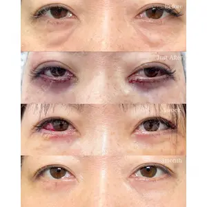 eクリニック 福岡院 伊藤 渉医師の症例