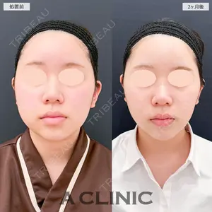 A CLINIC（エークリニック） 大阪院の症例