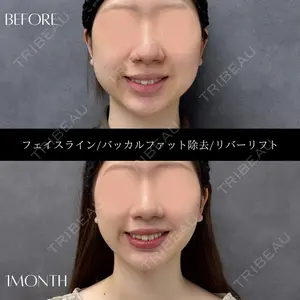 RIVER CLINIC（リバークリニック）大阪院の症例