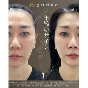 gift clinic 能登谷 翔医師の症例