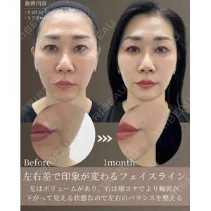 gift clinic 能登谷 翔医師の症例