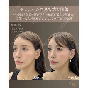 gift clinic 能登谷 翔医師の症例