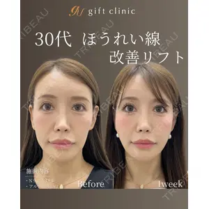 gift clinic 能登谷 翔医師の症例
