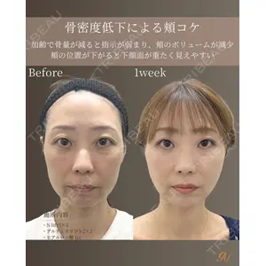 gift clinic 能登谷 翔医師の症例