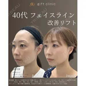 gift clinic 能登谷 翔医師の症例