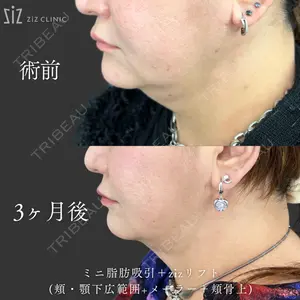 ziz CLINIC 村岡 史子医師の症例