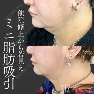 ziz CLINIC 村岡 史子医師の症例