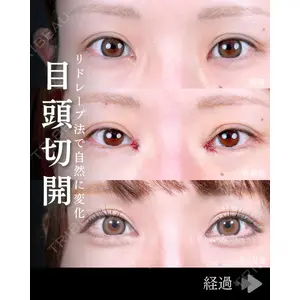 東京シンデレラ美容外科 池袋院 石井 達也医師の症例