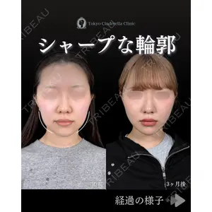 東京シンデレラ美容外科 池袋院 石井 達也医師の症例