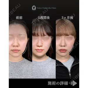 東京シンデレラ美容外科 池袋院 石井 達也医師の症例
