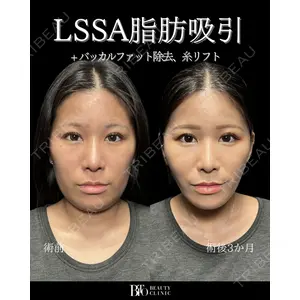 BITO BEAUTY CLINIC 伊藤 富良野医師の症例