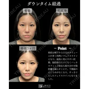 BITO BEAUTY CLINIC 伊藤 富良野医師の症例