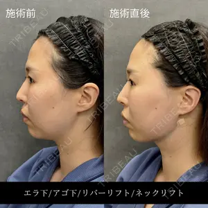RIVER CLINIC（リバークリニック）大阪院の症例