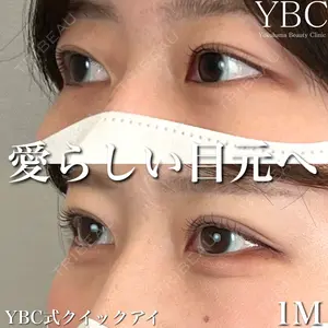 YBC横浜美容外科 池袋院 磯村 亮輔医師の症例