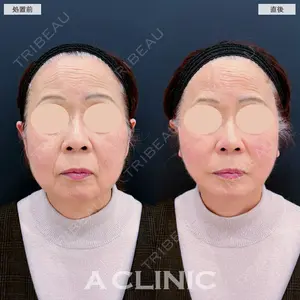 A CLINIC（エークリニック） 仙台院 伊藤 瑠桂医師の症例