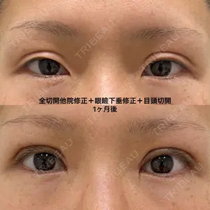 エターナル美容クリニック 久門田 詳医師の症例