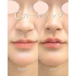 ルラ美容クリニック 札幌大通り院 能登 貴弘医師の症例
