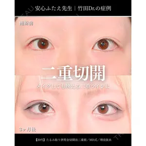 東京シンデレラ美容外科 大宮院 竹田 昌平医師の症例