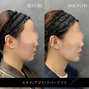 RIVER CLINIC（リバークリニック）大阪院の症例